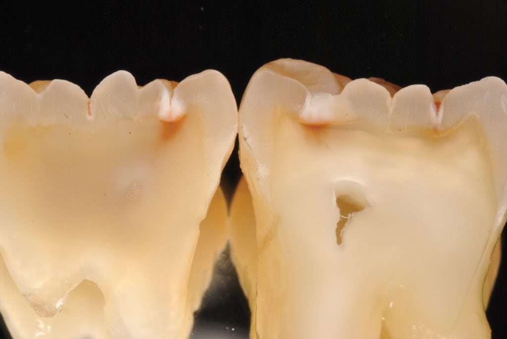 Southington Dentistry | Plantsville Dental Implants, Dental Crowns and Dental Fillings