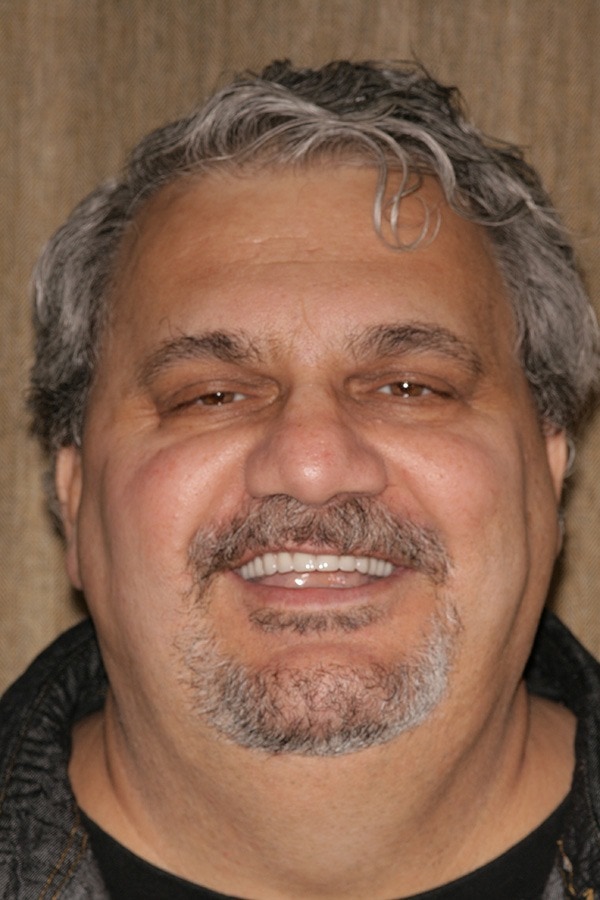 Southington Dentistry | Sedation Dentistry, Teeth Whitening and Gum Disease