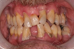 Southington Dentistry | Dental Fillings, Dental Bridges and Cosmetic Dentistry